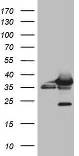 CBR / CBR1 Antibody - HEK293T cells were transfected with the pCMV6-ENTRY control. (Left lane) or pCMV6-ENTRY CBR1. (Right lane) cDNA for 48 hrs and lysed. Equivalent amounts of cell lysates. (5 ug per lane) were separated by SDS-PAGE and immunoblotted with anti-CBR1. (1:2000)