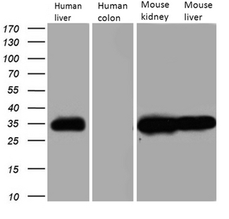 CBR / CBR1 Antibody - Western blot analysis of extracts. (35ug) from 4 different tissue lysates by using anti-CBR1 monoclonal antibody. (1:500)