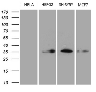 CBR / CBR1 Antibody - Western blot analysis of extracts. (35ug) from 4 different cell lines by using anti-CBR1 monoclonal antibody. (1:500)
