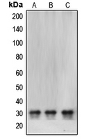 CBR / CBR1 Antibody - Western blot analysis of CBR1 expression in SHSY5Y (A); HeLa (B); MCF7 (C) whole cell lysates.
