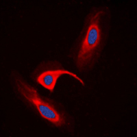 CBR / CBR1 Antibody - Immunofluorescent analysis of CBR1 staining in HeLa cells. Formalin-fixed cells were permeabilized with 0.1% Triton X-100 in TBS for 5-10 minutes and blocked with 3% BSA-PBS for 30 minutes at room temperature. Cells were probed with the primary antibody in 3% BSA-PBS and incubated overnight at 4 C in a humidified chamber. Cells were washed with PBST and incubated with a DyLight 594-conjugated secondary antibody (red) in PBS at room temperature in the dark. DAPI was used to stain the cell nuclei (blue).