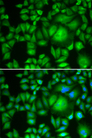 CBR / CBR1 Antibody - Immunofluorescence analysis of HeLa cells.