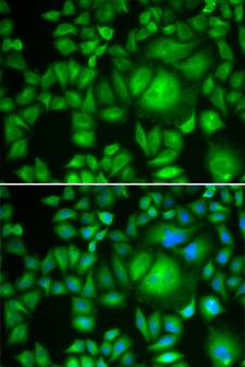 CBR / CBR1 Antibody - Immunofluorescence analysis of HeLa cells.