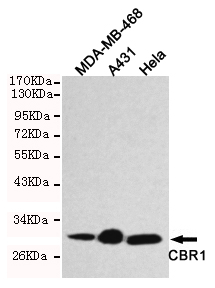 CBR / CBR1 Antibody - Western blot detection of CBR1 in HeLa, A431 and MDA-MB-468 cell lysates using CBR1 mouse monoclonal antibody (1:1000 dilution). Predicted band size: 30KDa, Observed band size:30KDa.