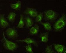 CBR / CBR1 Antibody - Immunocytochemistry stain of HeLa using CBR1 mouse monoclonal antibody (1:100).