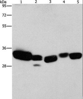 CBR / CBR1 Antibody - Western blot analysis of Mouse liver and human fetal lung tissue, HeLa cell and mouse kidney tissue, human brain malignant glioma tissue, using CBR1 Polyclonal Antibody at dilution of 1:900.