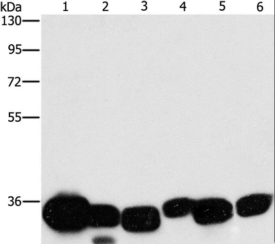 CBR / CBR1 Antibody - Western blot analysis of Mouse liver and human fetal lung tissue, HeLa cell and mouse kidney tissue, human brain malignant glioma tissue and K562 cell, using CBR1 Polyclonal Antibody at dilution of 1:1000.