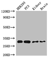 CBR / CBR1 Antibody - Positive WB detected in:HEK293 whole cell lysate,PC3 whole cell lysate,Mouse kidney tissue,Mouse brain tissue;All lanes:CBR1 antibody at 2.5ug/ml;Secondary;Goat polyclonal to rabbit IgG at 1/50000 dilution;Predicted band size: 31,19 kDa;Observed band size: 31 kDa;