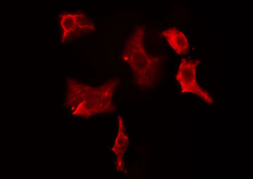 CBR / CBR1 Antibody - Staining HeLa cells by IF/ICC. The samples were fixed with PFA and permeabilized in 0.1% Triton X-100, then blocked in 10% serum for 45 min at 25°C. The primary antibody was diluted at 1:200 and incubated with the sample for 1 hour at 37°C. An Alexa Fluor 594 conjugated goat anti-rabbit IgG (H+L) antibody, diluted at 1/600, was used as secondary antibody.