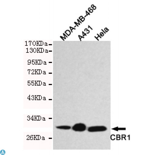 CBR / CBR1 Antibody - Western blot detection of CBR1 in Hela, A431 and MDA-MB-468 cell lysates using CBR1 mouse mAb (1:1000 diluted). Predicted band size: 30KDa, Observed band size: 30KDa.