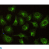 CBR / CBR1 Antibody - Immunocytochemistry stain of Hela using CBR1 mouse mAb (1:100).