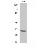 CBR3 Antibody - Western blot of Carbonyl Reductase 3 antibody