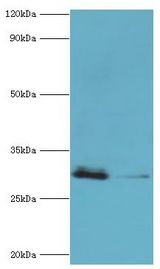 CBR3 Antibody - Western blot. All lanes: Carbonyl reductase [NADPH] 3 antibody at 10 ug/ml. Lane 1: HeLa whole cell lysate. Lane 2: K562 whole cell lysate. Secondary antibody: Goat polyclonal to rabbit at 1:10000 dilution. Predicted band size: 31 kDa. Observed band size: 31 kDa Immunohistochemistry.