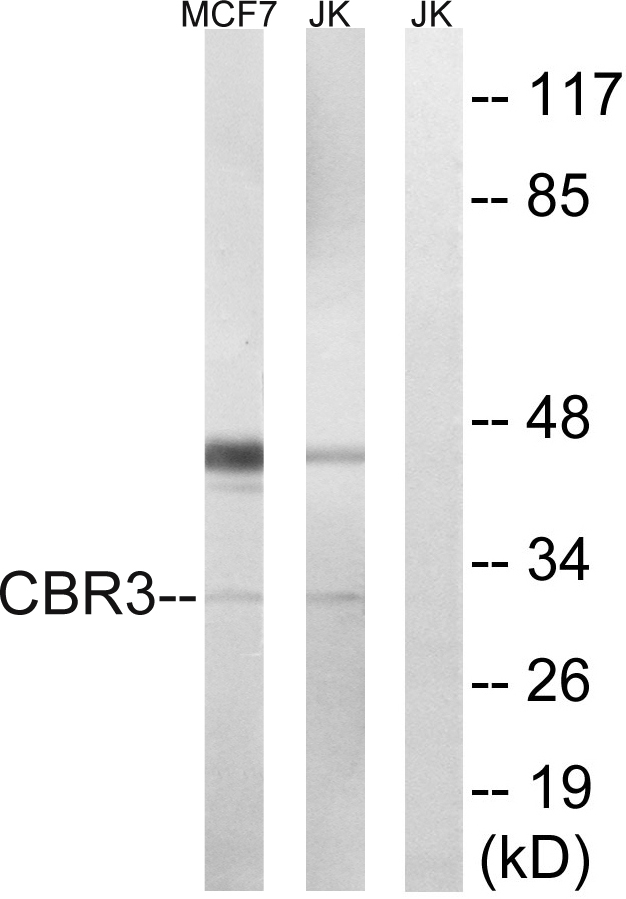 CBR3 Antibody - Western blot analysis of lysates from Jurkat and MCF7 cells, using CBR3 Antibody. The lane on the right is blocked with the synthesized peptide.
