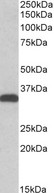CBR3 Antibody - Goat Anti-CBR3 Antibody (0.5µg/ml) staining of HEK293 lysate (35µg protein in RIPA buffer). Primary incubation was 1 hour. Detected by chemiluminescencence.
