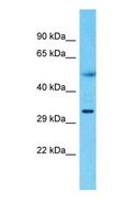 CBR3 Antibody - Western blot of CBR3 Antibody with Colorectal Tumor lysate.  This image was taken for the unconjugated form of this product. Other forms have not been tested.