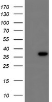 CBR3 Antibody - HEK293T cells were transfected with the pCMV6-ENTRY control (Left lane) or pCMV6-ENTRY CBR3 (Right lane) cDNA for 48 hrs and lysed. Equivalent amounts of cell lysates (5 ug per lane) were separated by SDS-PAGE and immunoblotted with anti-CBR3.