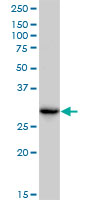 CBR3 Antibody - CBR3 monoclonal antibody (M05), clone 1G8. Western Blot analysis of CBR3 expression in HepG2.