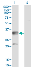 CBR3 Antibody - Western Blot analysis of CBR3 expression in transfected 293T cell line by CBR3 monoclonal antibody (M05), clone 1G8.Lane 1: CBR3 transfected lysate (Predicted MW: 30.9 KDa).Lane 2: Non-transfected lysate.