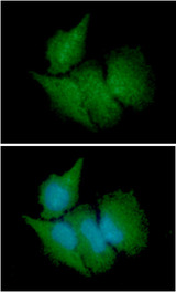CBR3 Antibody - ICC/IF analysis of CBR3 in HeLa cells line, stained with DAPI (Blue) for nucleus staining and monoclonal anti-human CBR3 antibody (1:100) with goat anti-mouse IgG-Alexa fluor 488 conjugate (Green).