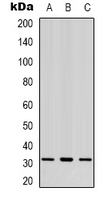 CBR3 Antibody - Western blot analysis of CBR3 expression in K562 (A); MCF7 (B); HeLa (C) whole cell lysates.