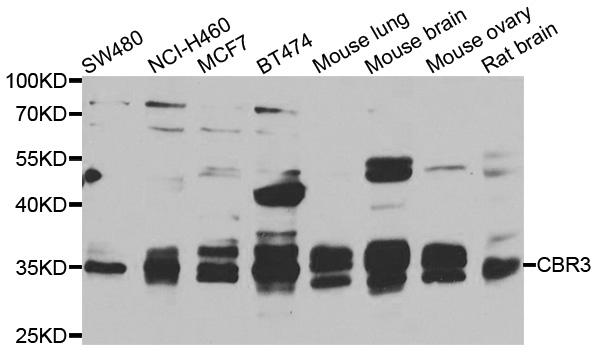 CBR3 Antibody - Western blot analysis of extracts of various cell lines.