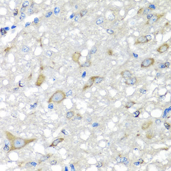 CBR3 Antibody - Immunohistochemistry of paraffin-embedded rat brain tissue.