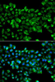 CBR3 Antibody - Immunofluorescence analysis of A549 cells.