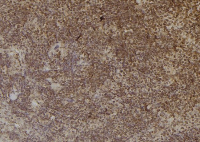 CBR3 Antibody - 1:100 staining mouse spleen tissue by IHC-P. The sample was formaldehyde fixed and a heat mediated antigen retrieval step in citrate buffer was performed. The sample was then blocked and incubated with the antibody for 1.5 hours at 22°C. An HRP conjugated goat anti-rabbit antibody was used as the secondary.