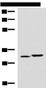 CBR3 Antibody - Western blot analysis of 293T cell lysates  using CBR3 Polyclonal Antibody at dilution of 1:800