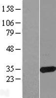 CBR3 Protein - Western validation with an anti-DDK antibody * L: Control HEK293 lysate R: Over-expression lysate