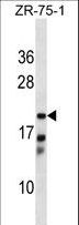 CBR4 Antibody - CBR4 Antibody western blot of ZR-75-1 cell line lysates (35 ug/lane). The CBR4 antibody detected the CBR4 protein (arrow).