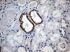 CBR4 Antibody - Immunohistochemical staining of paraffin-embedded Human Kidney tissue within the normal limits using anti-CBR4 mouse monoclonal antibody. (Heat-induced epitope retrieval by 1mM EDTA in 10mM Tris buffer. (pH8.5) at 120°C for 3 min. (1:150)