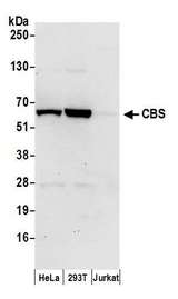 CBS Antibody - Detection of human CBS by western blot. Samples: Whole cell lysate (50 µg) from HeLa, HEK293T, and Jurkat cells prepared using NETN lysis buffer. Antibody: Affinity purified rabbit anti-CBS antibody used for WB at 0.1 µg/ml. Detection: Chemiluminescence with an exposure time of 30 seconds.