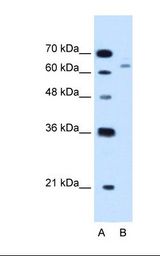 CBS Antibody - Lane A: Marker. Lane B: HepG2 cell lysate. Antibody concentration: 1.25 ug/ml. Gel concentration: 12%.  This image was taken for the unconjugated form of this product. Other forms have not been tested.