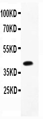 CBS Antibody - CBS antibody Western blot. All lanes: Anti CBS at 0.5 ug/ml. WB: Recombinant human CBS Protein 0.5ng. Predicted band size: 42 kD. Observed band size: 42 kD.