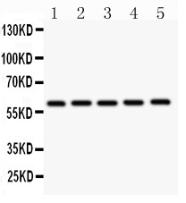 CBS Antibody - CBS antibody Western blot. All lanes: Anti CBS at 0.5 ug/ml. Lane 1: Rat Liver Tissue Lysate at 50 ug. Lane 2: Rat Brain Tissue Lysate at 50 ug. Lane 3: HeLa Whole Cell Lysate at 40 ug. Lane 4: PANC Whole Cell Lysate at 40 ug. Lane 5: Hepg2 Whole Cell Lysate at 40 ug. Predicted band size: 60 kD. Observed band size: 60 kD.