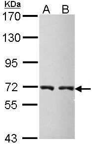 CBS Antibody - Sample (30 ug of whole cell lysate). A: Molt-4 , B: Raji. 7.5% SDS PAGE. CBS antibody diluted at 1:5000.