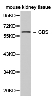 CBS Antibody - Western blot of extracts of mouse kidney tissue, using CBS antibody.