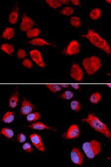 CBS Antibody - Immunofluorescence analysis of U2OS cells using CBS antibody. Blue: DAPI for nuclear staining.