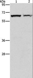 CBS Antibody - Western blot analysis of Mouse pancreas and human fetal liver tissue, using CBS Polyclonal Antibody at dilution of 1:550.