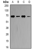CBS Antibody - Western blot analysis of CBS expression in HeLa (A); MCF7 (B); Romas (C); mouse brain (D) whole cell lysates.