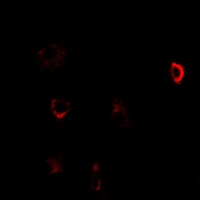 CBS Antibody - Immunofluorescent analysis of CBS staining in U2OS cells. Formalin-fixed cells were permeabilized with 0.1% Triton X-100 in TBS for 5-10 minutes and blocked with 3% BSA-PBS for 30 minutes at room temperature. Cells were probed with the primary antibody in 3% BSA-PBS and incubated overnight at 4 deg C in a humidified chamber. Cells were washed with PBST and incubated with a DyLight 594-conjugated secondary antibody (red) in PBS at room temperature in the dark.