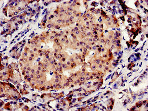 CBS Antibody - Immunocytochemistry analysis of human pancreatic tissue at a dilution of 1:100