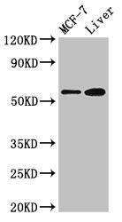 CBS Antibody - Positive Western Blot detected in MCF-7 whole cell lysate, Mouse liver tissue. All lanes: CBS antibody at 2.7 µg/ml Secondary Goat polyclonal to rabbit IgG at 1/50000 dilution. Predicted band size: 61, 62 KDa. Observed band size: 61 KDa