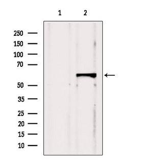 CBS Antibody - Western blot analysis of extracts of HeLa cells using CBS antibody. Lane 1 was treated with the blocking peptide.