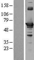 CBS Protein - Western validation with an anti-DDK antibody * L: Control HEK293 lysate R: Over-expression lysate