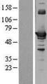 CBS Protein - Western validation with an anti-DDK antibody * L: Control HEK293 lysate R: Over-expression lysate