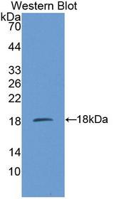 CBT1 / SDHD Antibody - Western blot of CBT1 / SDHD antibody.