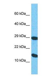CBT1 / SDHD Antibody - Western blot of SDHD Antibody with human HepG2 Whole Cell lysate.  This image was taken for the unconjugated form of this product. Other forms have not been tested.